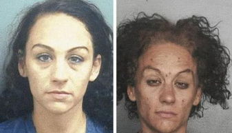 女生確診漸凍癥容貌巨變 母親回應(yīng)